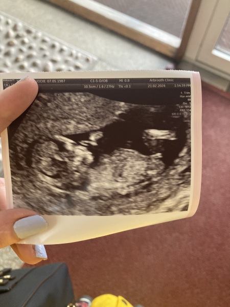 12 weeks 3 days scan. Can anyone tell the gender?