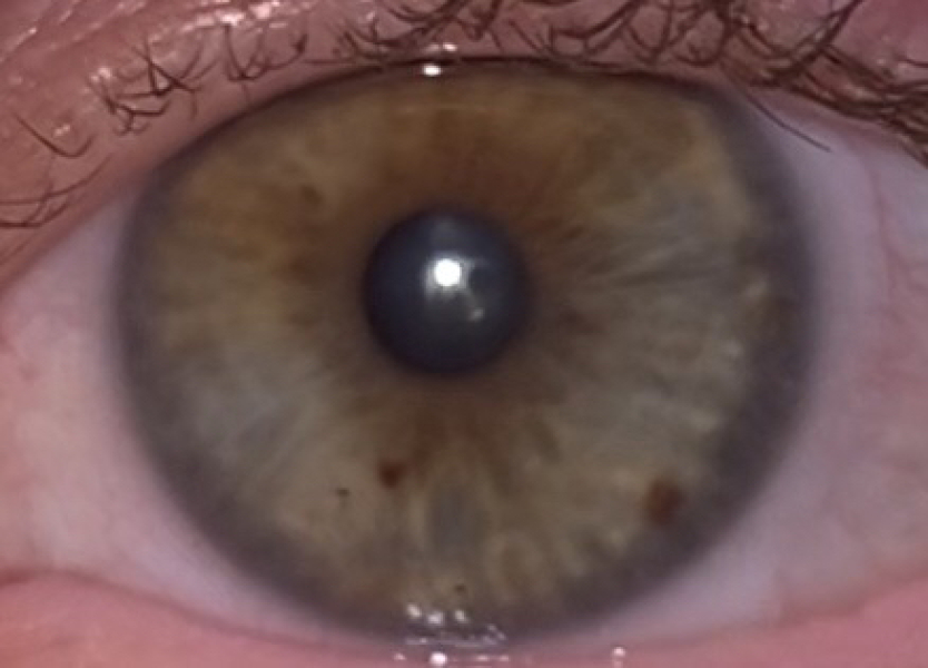 Hazel or Brown? Pic included
