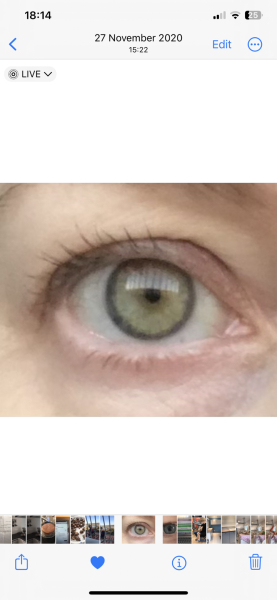 Hazel or Brown? Pic included
