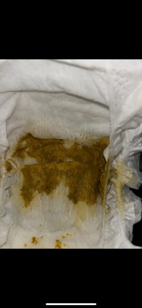 Does this look like cmpa? TMI pics