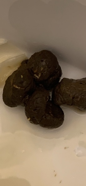 Is this worms? (WARNING picture!!!)