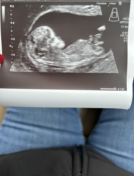 Due September 2024 - Part 4! 🤰🏻💙🩷