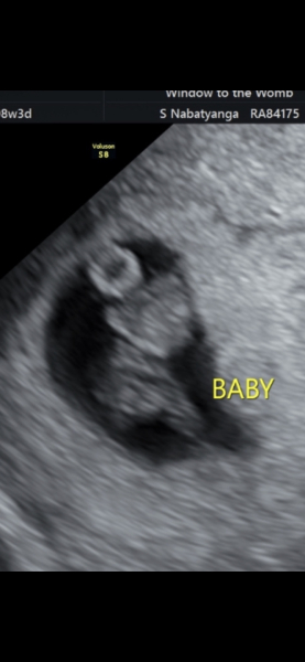 Due September 2024 - Part 4! 🤰🏻💙🩷