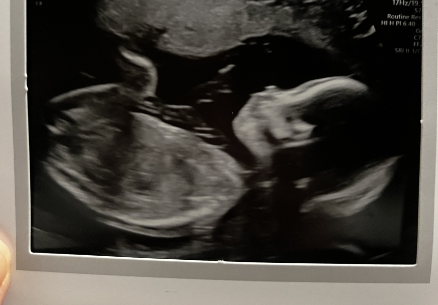 POAS come on you rainbows