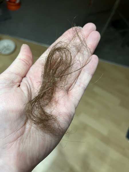 Is it normal to lose this much hair when washing/brushing it?