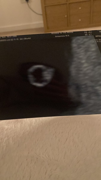 OCTOBER 2024 BABIES!