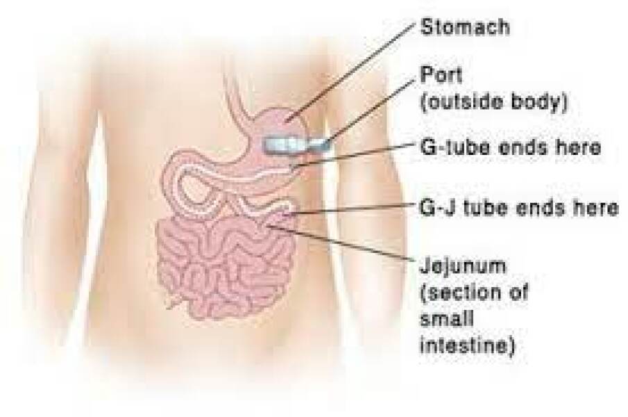 Thread 12 - TalkLair: “I say we take off and nuke the entire site from orbit. It's the only way to be sure.”