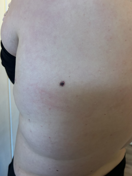 To be worrying myself sick? (Photo attached)