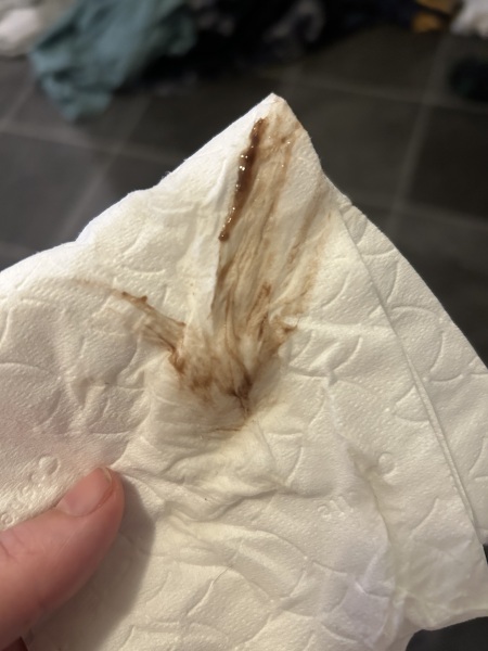 Bleeding after internal scan