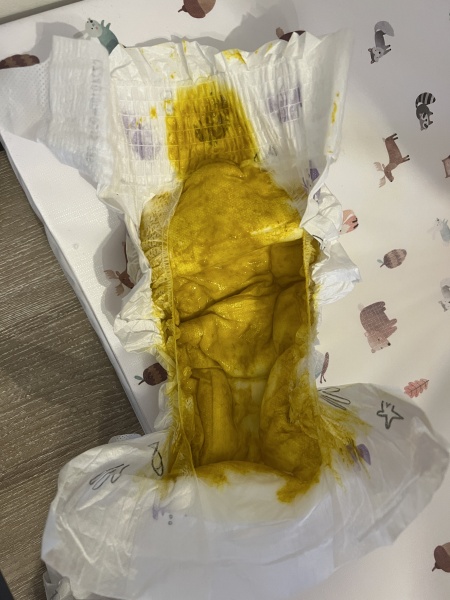 3 month old EBF baby poops suddenly a lot runnier