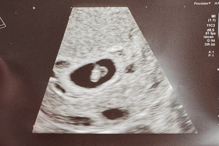 Due September 2024 PART 3 ❤️🩷💛💚💙💜