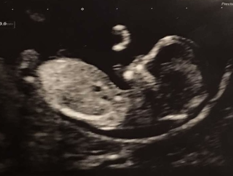 Gender guesses?