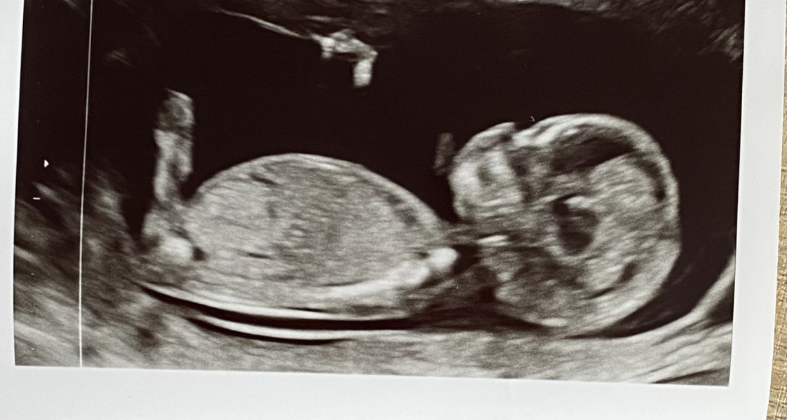 Due September 4.5 🐣♥️🧡💜