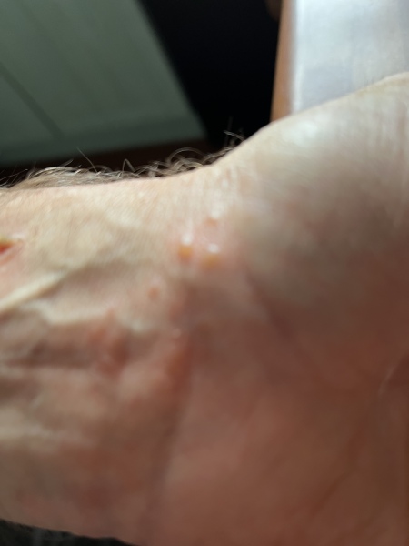 Long term itchy rash, photo inc. GP no idea