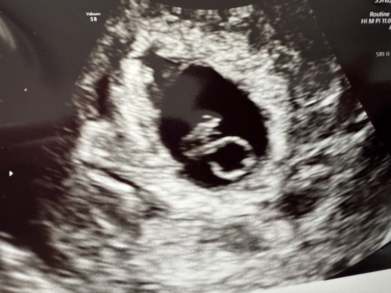 Due September 2024 PART 3 ❤️🩷💛💚💙💜