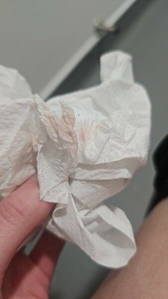 Is this implantation bleeding