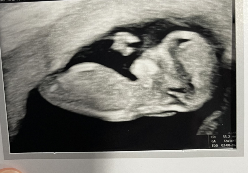 Can someone help confirm gender?