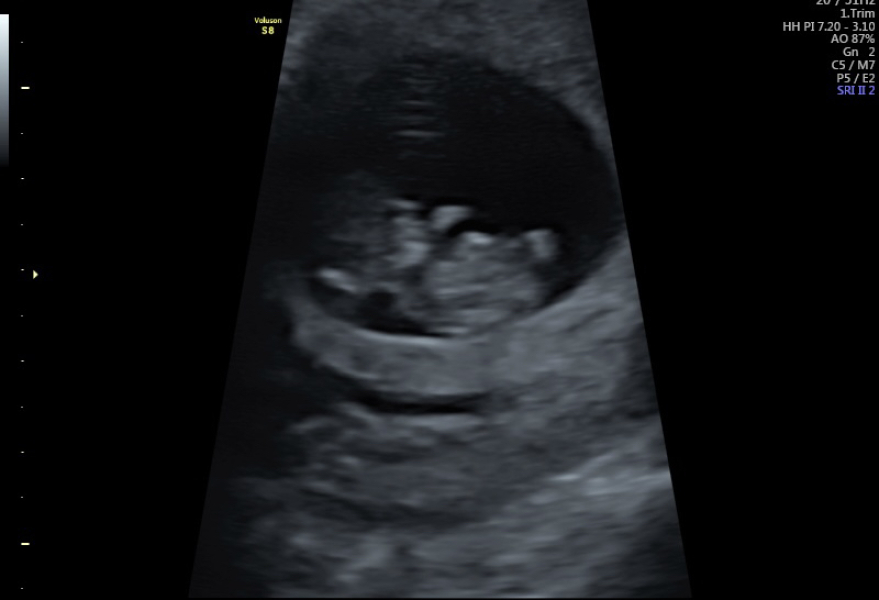 Due September 4.5 🐣♥️🧡💜