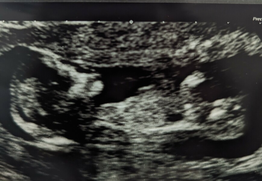 Girl or boy?