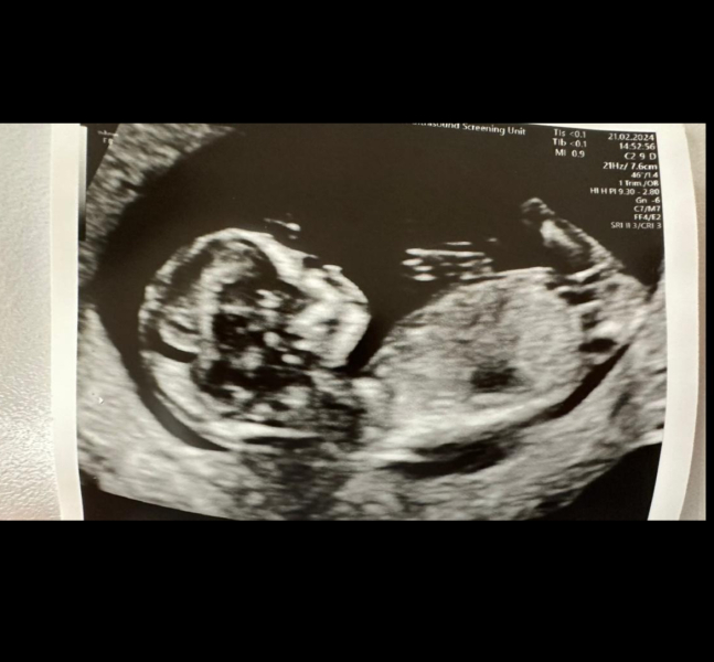 Do you want me to guess the sex? 12 week scans.