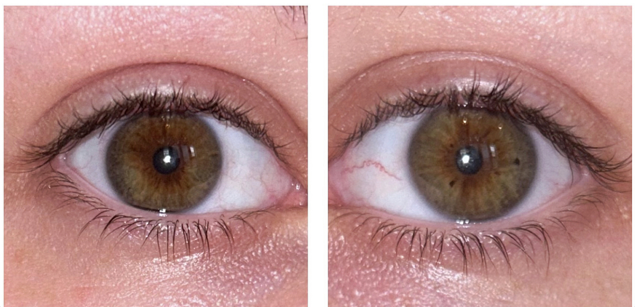 Hazel or Brown? Pic included