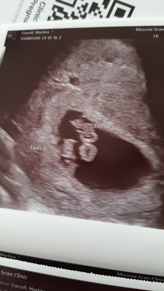 Due September 2024 PART 3 ❤️🩷💛💚💙💜