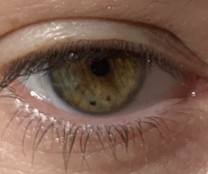 Hazel or Brown? Pic included