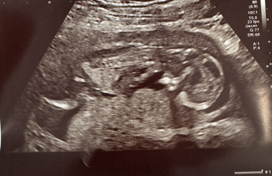 Due September 4.5 🐣♥️🧡💜