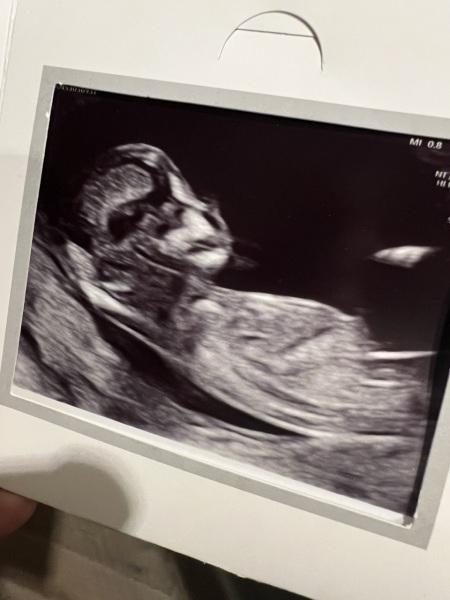 Baby sex guess