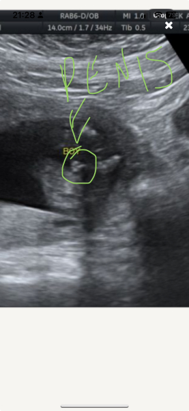 Gender scan gone wrong?