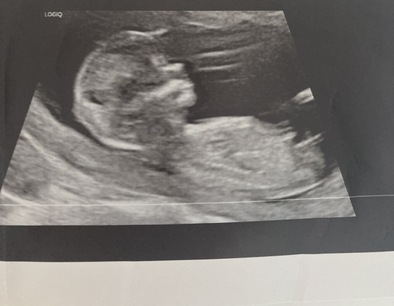 Gender Guesses!