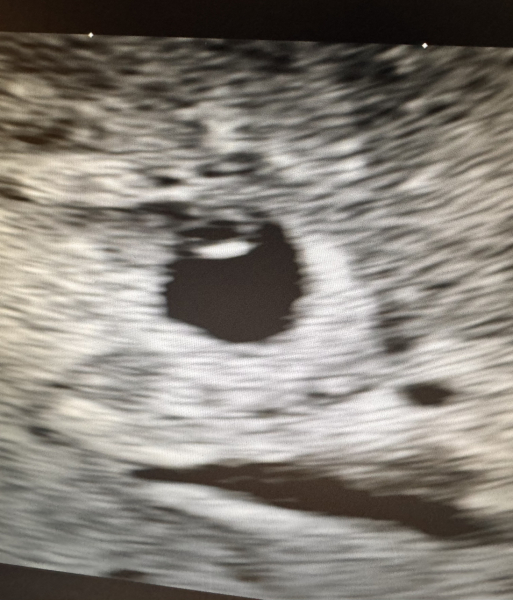 OCTOBER 2024 BABIES!