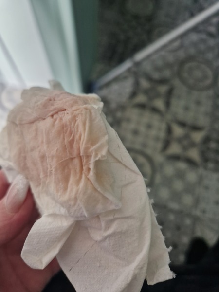 Implantation Bleeding