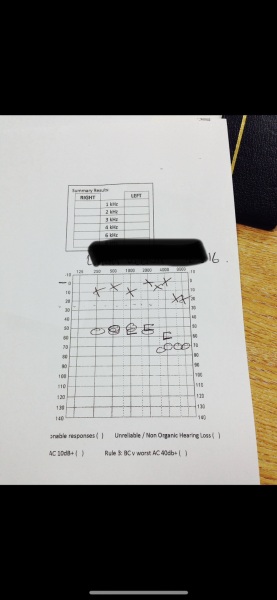 Any audiologists on here?