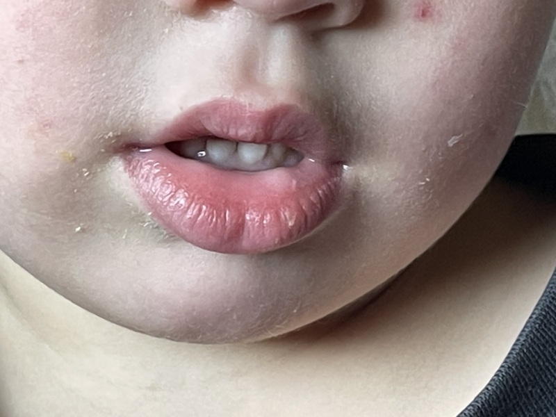 Start of a cold core?