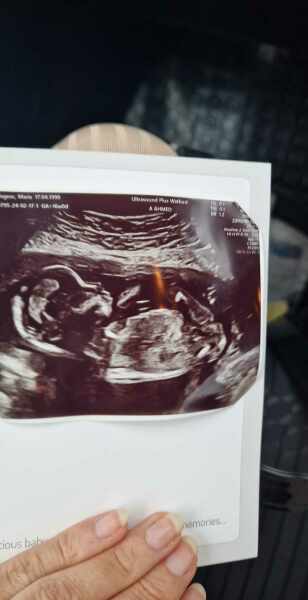 Potty shot at 16 weeks - has yours been wrong?