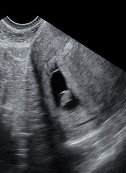 OCTOBER 2024 BABIES!