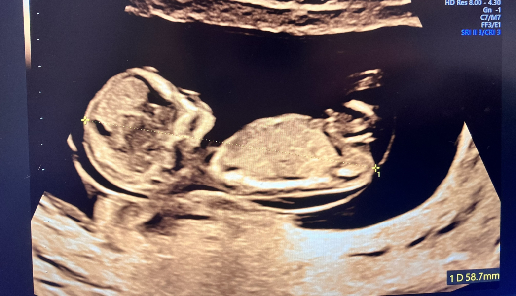 Due September 4.5 🐣♥️🧡💜