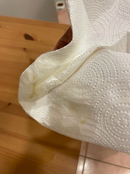 Anal glands and secretions??? Gross pic alert!