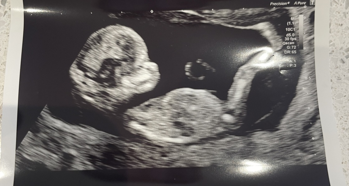 Help Gender guess please!