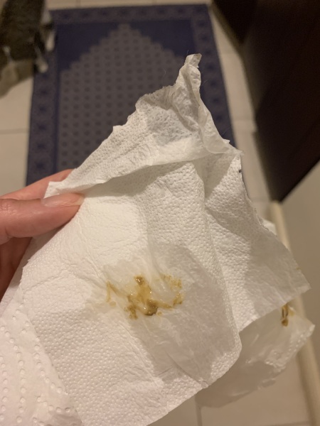 Anal glands and secretions??? Gross pic alert!