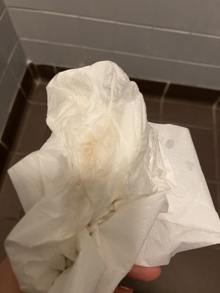 Implantation bleeding?