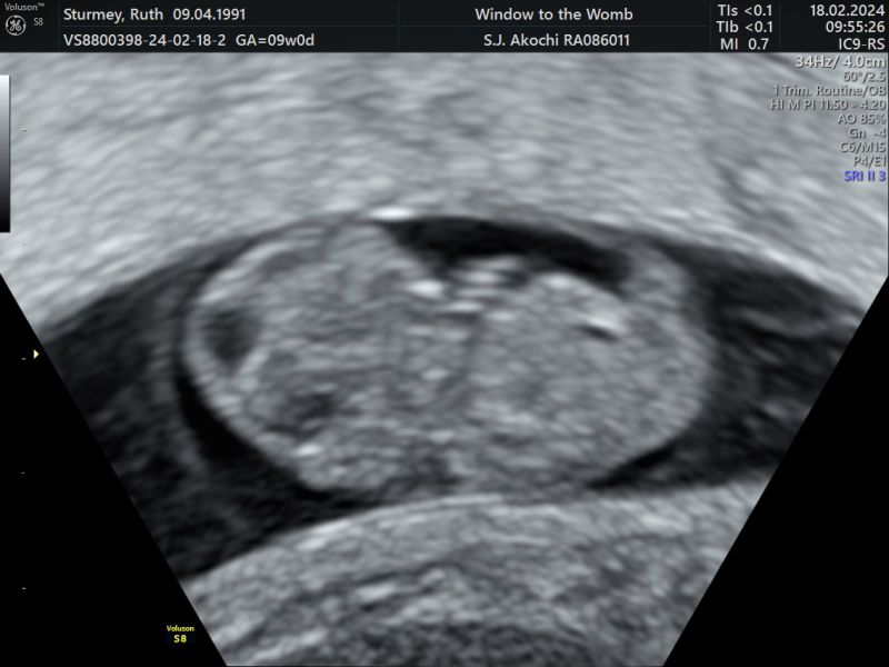 Due September 2024 - Part 4! 🤰🏻💙🩷