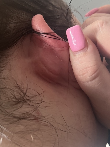 Health anxiety will be the death of me!