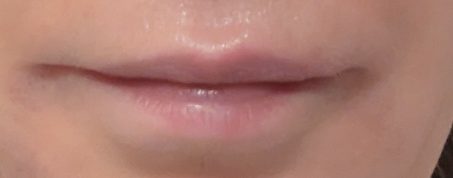 What can I do to improve my lips?