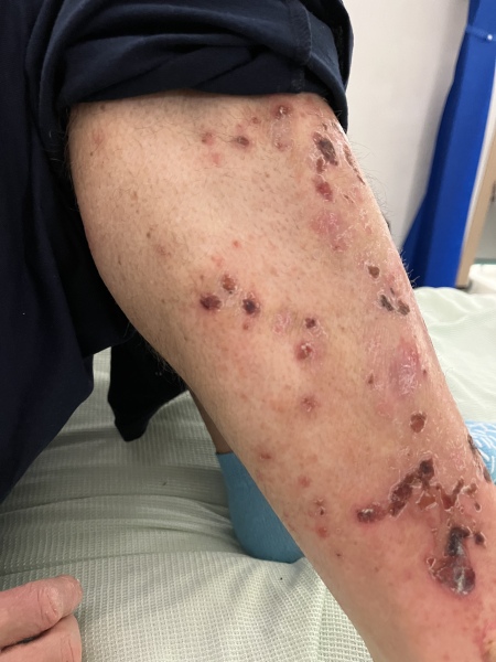 Long term itchy rash, photo inc. GP no idea