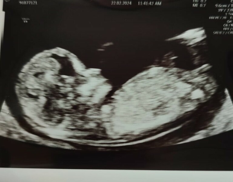 Due September 4.5 🐣♥️🧡💜