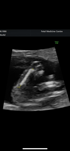 Poty shot: girl or boy?