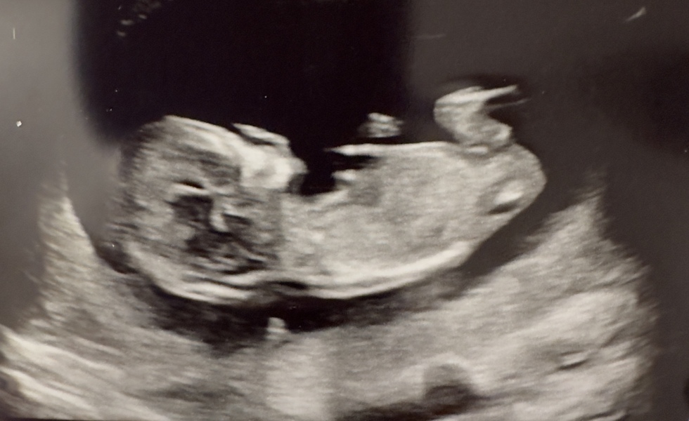 Boy or Girl?
