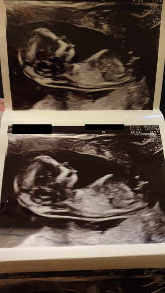 13 Weeks - Nub Game!